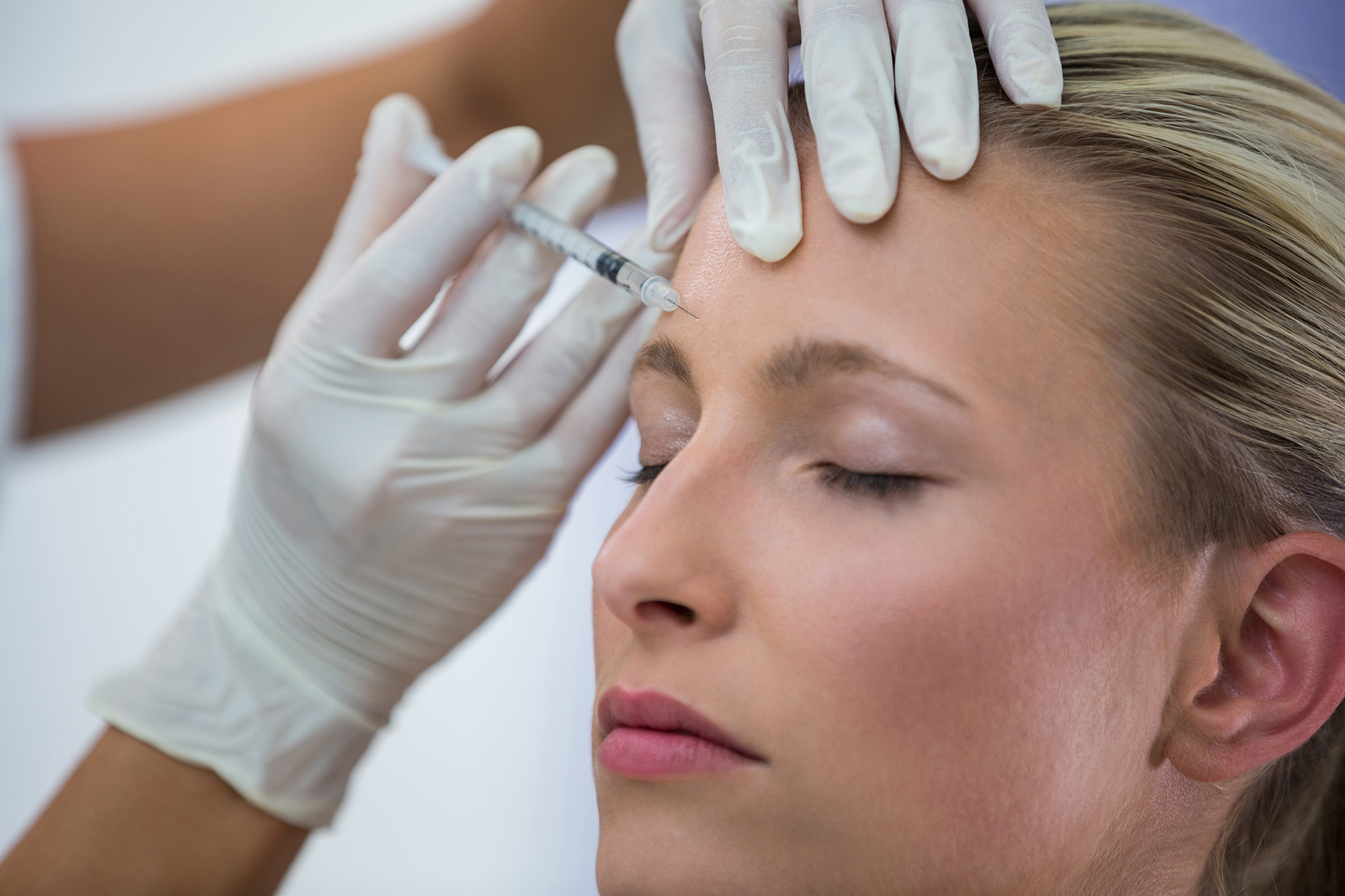 Mesoterapia facial